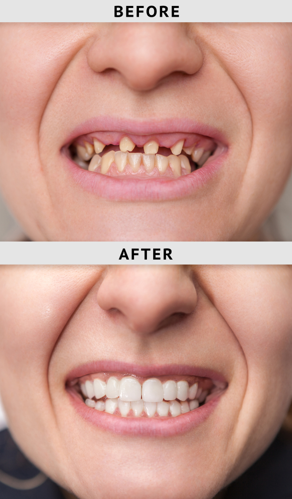 What Is the Importance of Cosmetic Dentistry?
